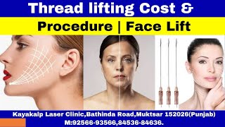 Download Lagu Thread lifting Cost u0026 Procedure | Face Lift Thumbnail