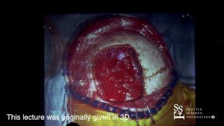 Microneurosurgical Approaches to Deep Brain Lesions by Guilherme Carvalhal Ribas, MD
