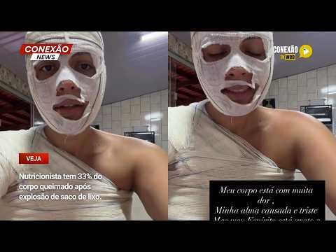 Vídeo: Nutricionista tem 33% do corpo queimado após explosão de saco de lixo.
