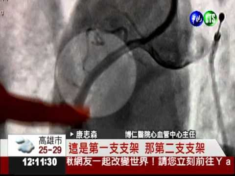 女跳舞腹痛休克 心肌梗塞險丟命