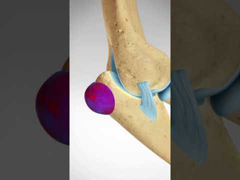 Guess The Spine Injury And Procedure Challenge