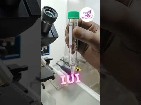 IUI Treatment for pregnancy | IUI कैसे किया जाता है | Dr. Suman Bhooker