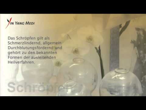 Akupunktur Klinik - Chinesische Schröpftechnik, Schröpfen - Yin Yang Medi AG Burgdorf