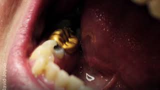 How cremation actually works