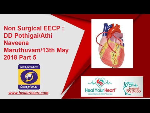 EECP Non Surgical Heart Treatment Explained | DD Pothigai Athi Naveena Maruthuvam | Part5 