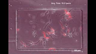 Aspergillus fumigatus growing inside a microfluidic chamber.