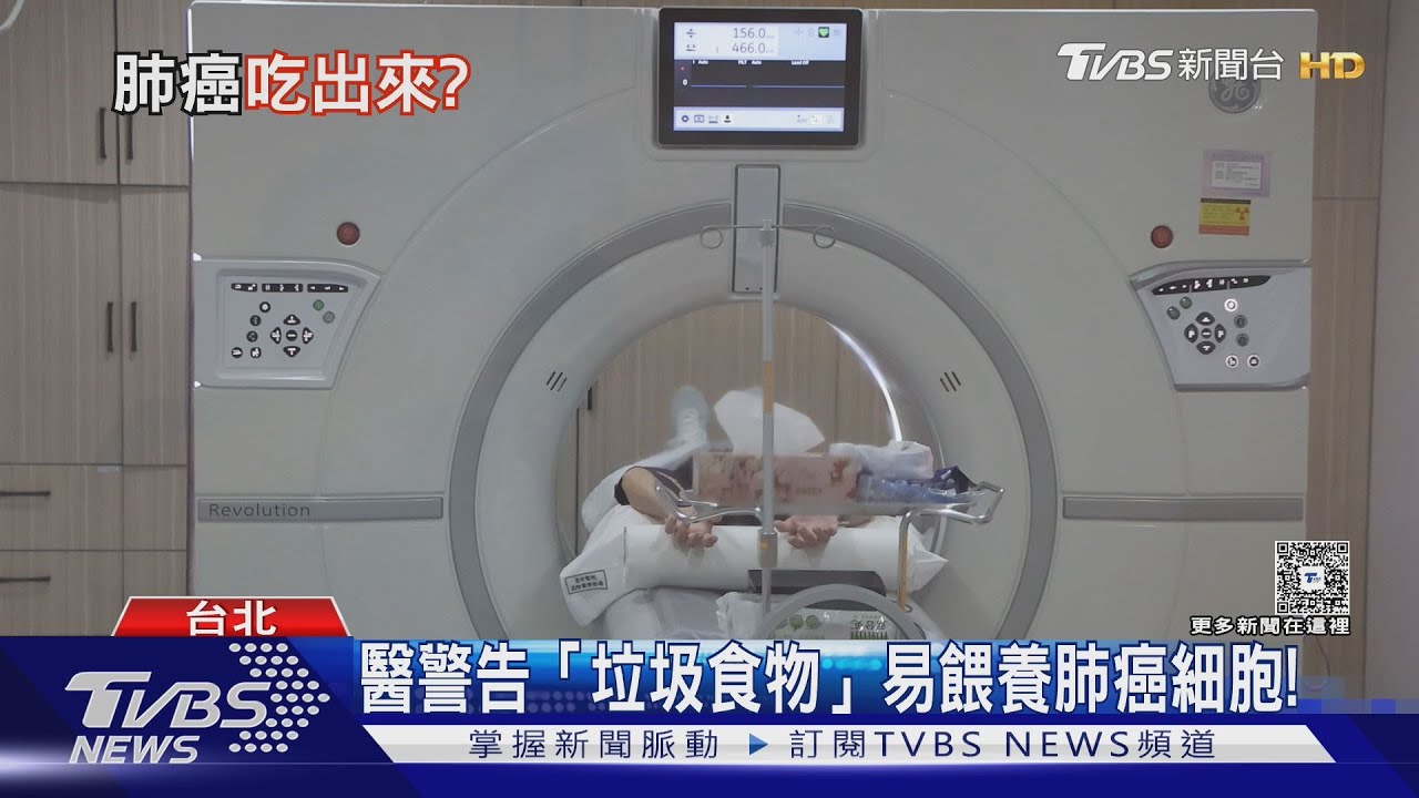 肺癌恐吃出來?!經常吃這兩類食物 醫師:恐助長癌細胞!