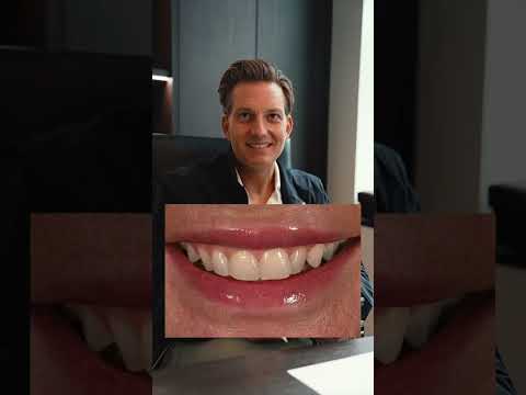 Restoring youthfulness through Cosmetic Dentistry - PORCELAIN VENEERS