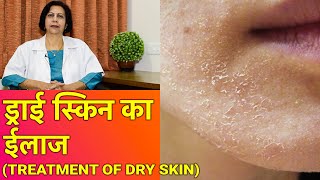 सूखी त्वचा - ड्राई स्किन का ईलाज || Dry Skin Treatment (In HINDI)