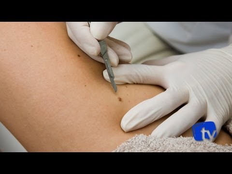 Mavit per il trattamento della prostata Se è possibile curare massaggio prostatico