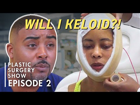 I Don't Want to Get a Keloid! || Beyond the Surface (S1 Ep2)
