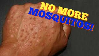 Mosquito Repellent | Home Remedy and Prevention Tips for Mosquito Bites!