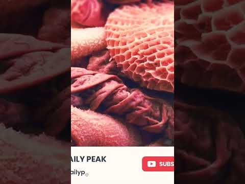 men avoid this | sperm killing foods | fertility. #shorts #fertility #sperm #shortsfeed #subscribe