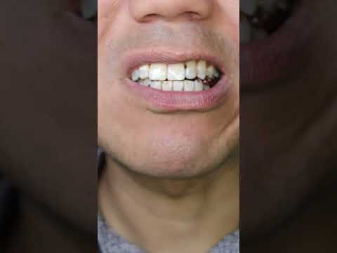 ASMR | Hershey's Special Dark Chocolate Candy Bar | Nothing a classic can't fix #DoctorTristanPeh
