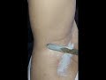 Thin Hair Undararm Wax Vairal Vedio