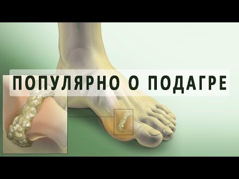 Лфк при разрыве связок коленных суставов Острые боли в поясницы