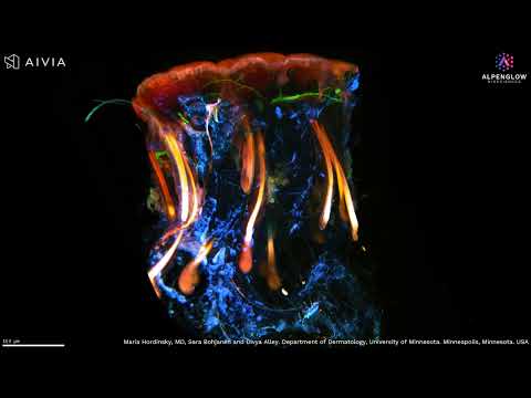 3D Imaging of Scalp Tissue for Alopecia Research