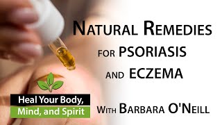 Home Remedies for Eczema and Psoriasis  - Barbara O