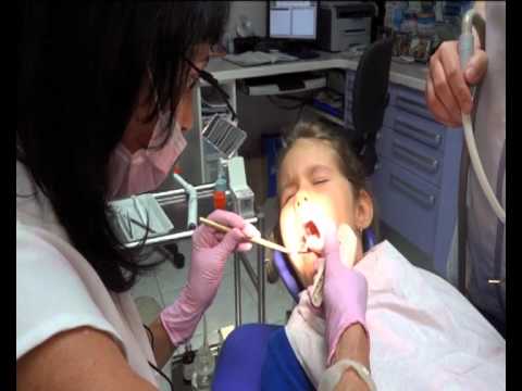 altatásos fogászati kezelések