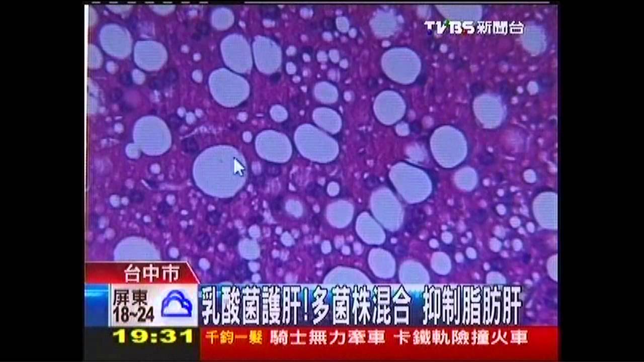 乳酸菌護肝!多菌株混合 抑制脂肪肝