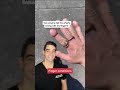 Enlarged Fingers