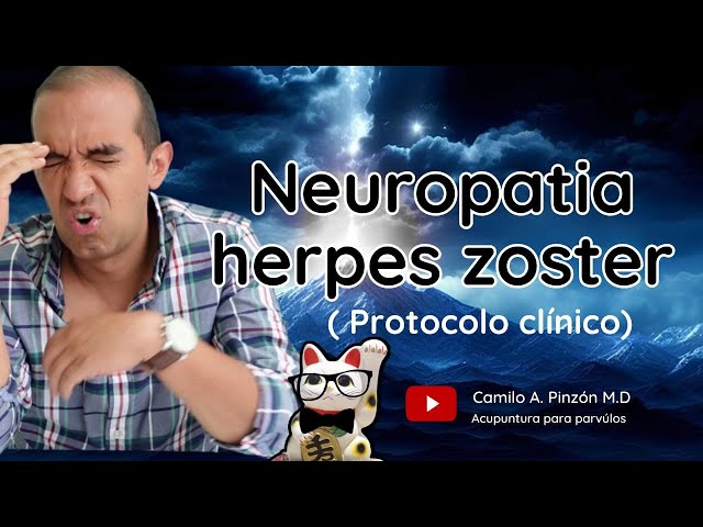 Vídeo relacionado con HERPES ZÓSTER Y NEURALGIA POSHERPÉTICA: Protocolo Integral Multimodal: Medicina Convencional, Fitoterapia y Acupuntura por Etapas Clínicas