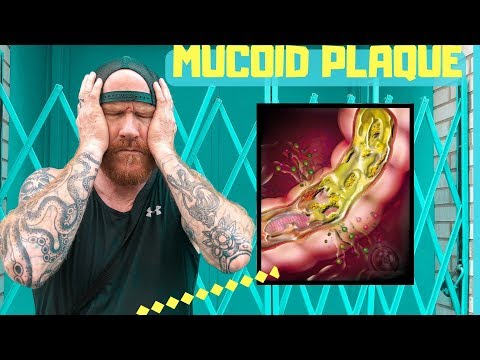 3 Best Ways To Remove Mucoid Plaque