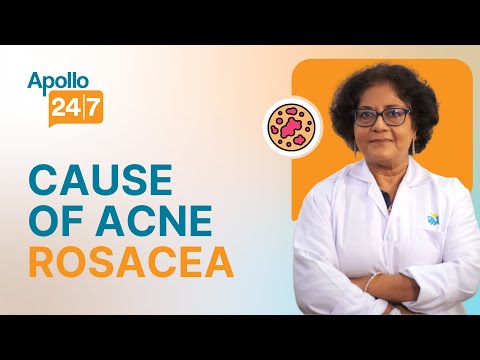 How To Deal With PCOD Acne Dr Koushik Lahiri