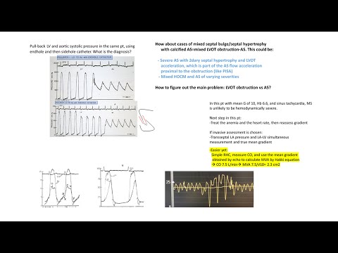 Hemodynamic cases- part 2