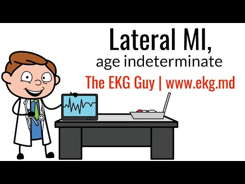 Lateral MI (age indeterminate) on EKG / ECG l The EKG Guy - www.ekg.md