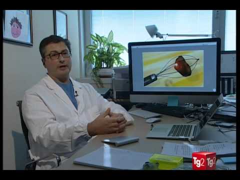 Parenchima calcificazione prostata Trattamento macellai di farmaci BPH negli uomini