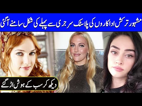 Turkish Actresses Before and After Plastic Surgery | Celeb City Official | TB2T