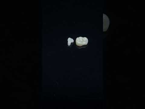YouTube 썸네일