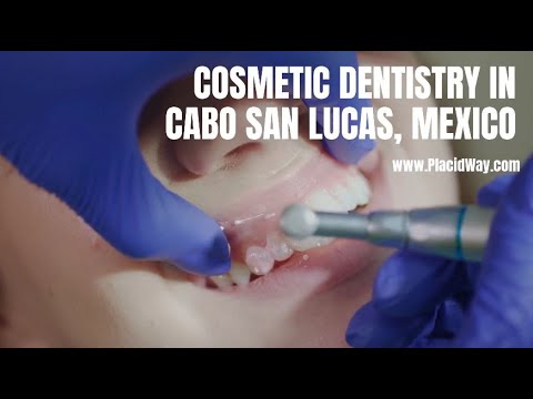 Cosmetic Dentistry in Cabo San Lucas, Mexico