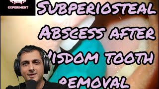 The Post-op Abscess after Wisdom Tooth Extraction and how to drain it @DrWahanExperiment