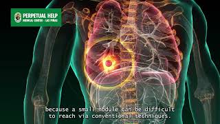 Augmented Fluoroscopic Bronchoscopy