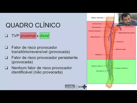 Trombose Venosa Profunda