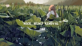 ▪︎°•- neck hump removal subliminal -•°▪︎(listen once/forced)