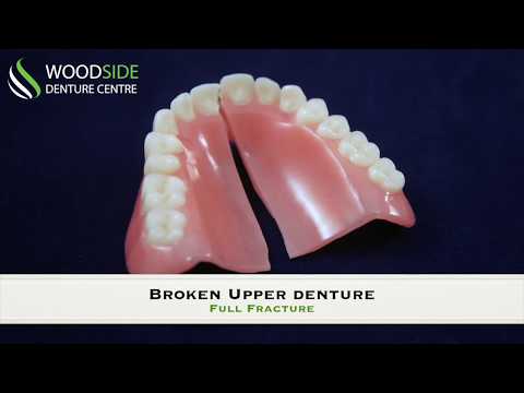 Denture Repair in Airdrie, AB | Woodside Denture Centre