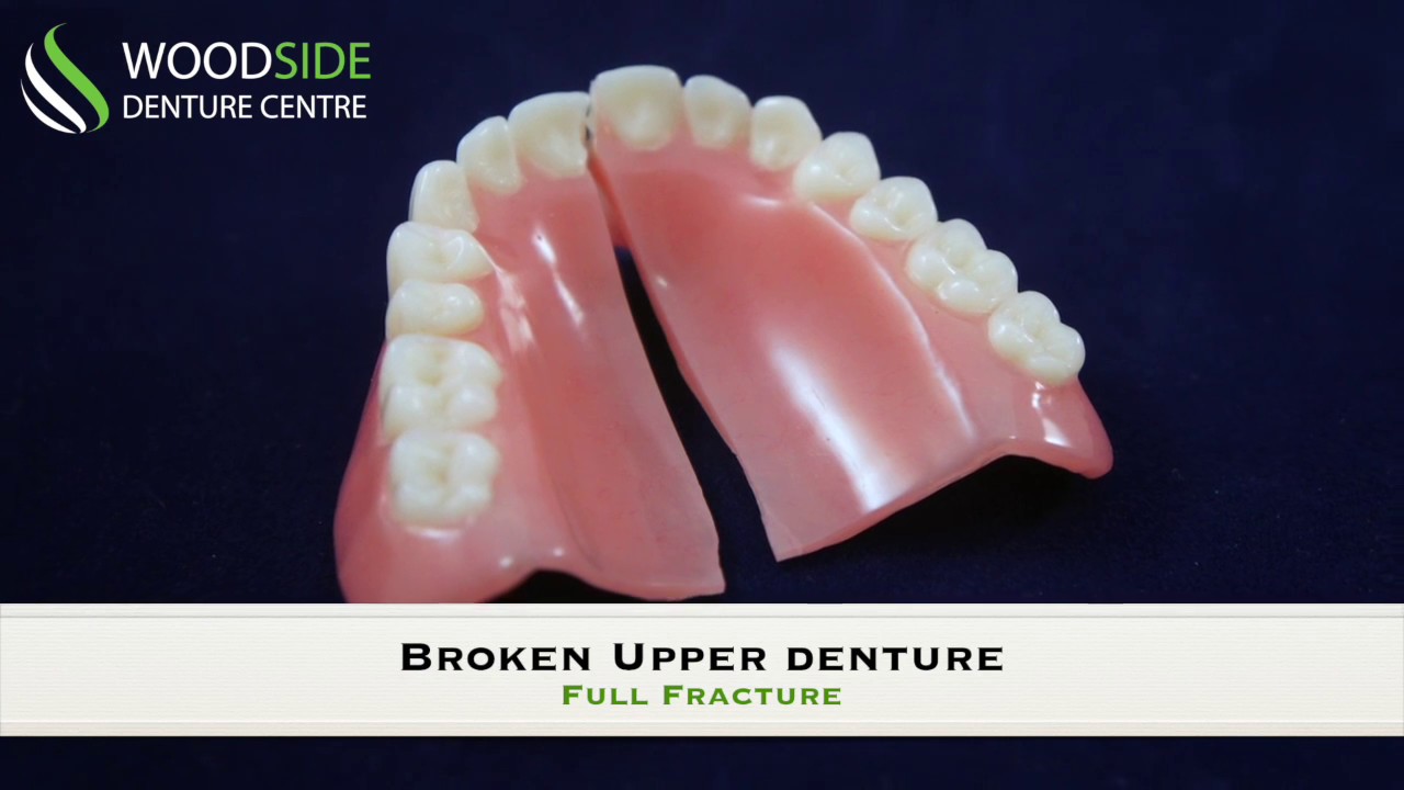Denture Repair in Airdrie, AB | Woodside Denture Centre