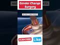 Male To Female Gender Reassignment Surgery Shorts Male Female Shortsvideo Shortsvideo Viral