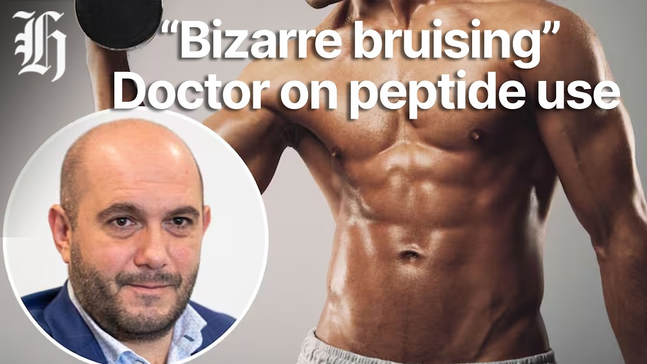 'Bizarre bruising': Doctor blows whistle over black-market peptide use