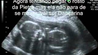 ultrassom da Pietra S. Montanari - 18 semanas