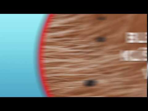 _label_product_video ARPALIT Neo 4.8/1.2 mg/g kožní pěna 150 ml