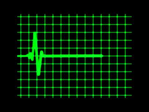 DTS Ft. Yazzer-G - Cypher 2