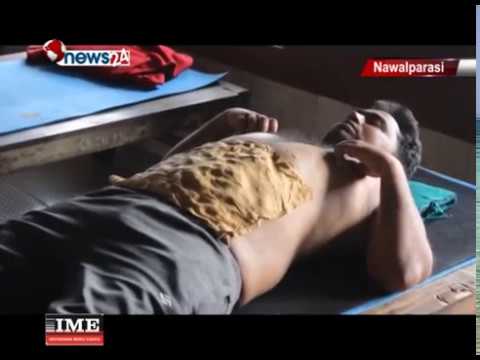 मानिसहरुको शरीरको सर्भिसिङ गराउन प्राकृतिक चिकित्सालयमा घुँइचो - NEWS24 TV