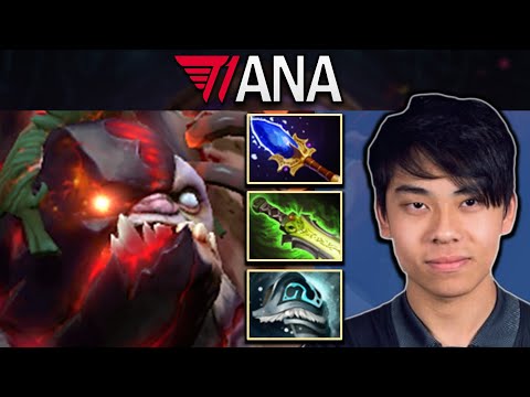 Pudge Dota 2 7.32 Gameplay T1.Ana with Ethereal Blade and Shivas #dota2 #dota2gameplay