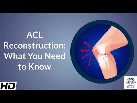 Frozen Shoulder Causes Signs and Symptoms Diagnosis and Treatment