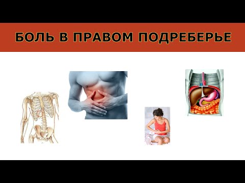Упражнения для восстановления коленного сустава при артрозе Артроз коленного сустава полужесткий