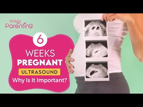 6 Weeks Pregnancy Ultrasound : Why Is It Important & What to Expect?